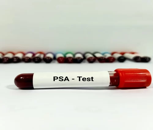 psa-degeri